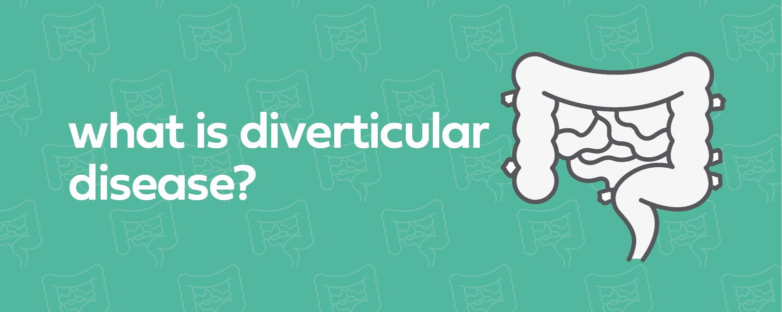 Expert Series FAQ Diverticular Disease